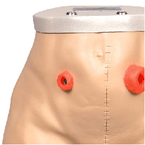 BJH Modelo de ileostomía de colostomía - Modelo de enfermería de ostomía de fístula Avanzada - para Suministros de enseñanza de capacitación y educación de enfermería, tamaño Real (Car