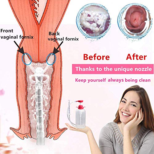 Cabeza de la boquilla reutilizable sistema - limpieza Vaginal para las mujeres, 100% seguro, capacidad de 600Ml con Extra 2 Cabeza de la boquilla(600ml)