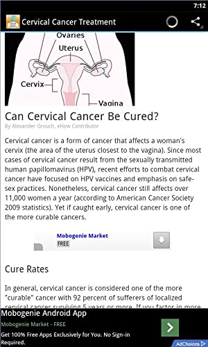 Cervical Cancer Treatment