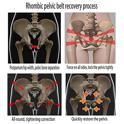 Cinturón Corrección Pélvica Inclinación Pélvica Anterior Corregir Ancho Cadera Falso Cinturón Transpirable Y Apretado para La Zona Pélvica Espalda Baja Y Dolor Piernas Ajuste Pélvico,L