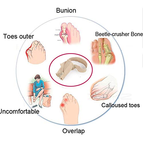 Corrector de juanetes, alivia el dolor de juanetes, para hallux valgus, calcetines ortopédicos para pulgar, de bola de pie, herramienta para el cuidado de pies de la inflamación de las articulaciones