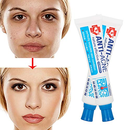 Crema Antiacne, Acné Crema, Acne Tratamiento, Reducir los Puntos negros, Equilibrar el Agua y el Aceite, la Crema Contra el Acné Espinilla Regenera la piel, 30 g