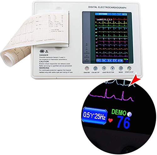 Denshine digital portátil ECG máquina 7 pulgadas multiparámetro 12 derivaciones 3 canales