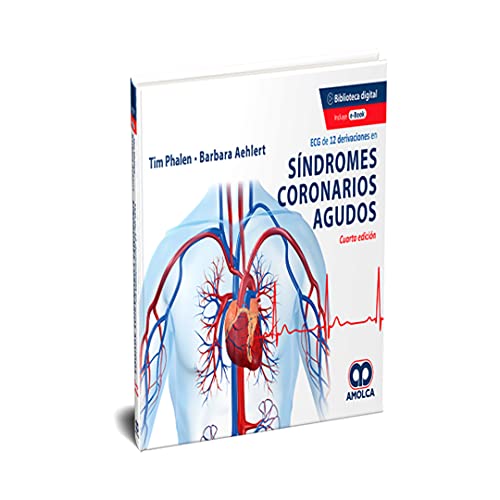 ECG DE 12 DERIVACIONES EN SINDROMES CORONARIOS AGUDOS