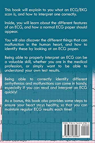 ECG & EKG Interpretation: How to interpret ECG & EKG, including rhythms, arrhythmias, and more!