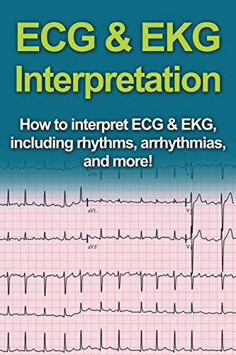 ECG & EKG Interpretation: How to interpret ECG & EKG, including rhythms, arrhythmias, and more!