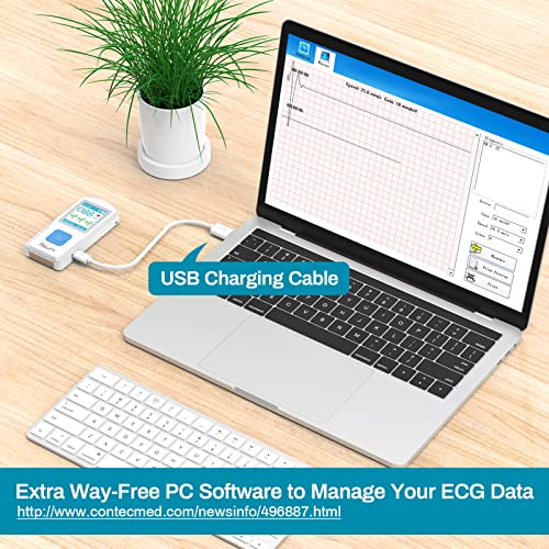 El monitor ECG portátil para rastrear la frecuencia y el ritmo cardíaco, el electrocardiógrafo cardíaco inalámbrico bluetooth hogar con pantalla OLED grande para iOS, Android y Windows