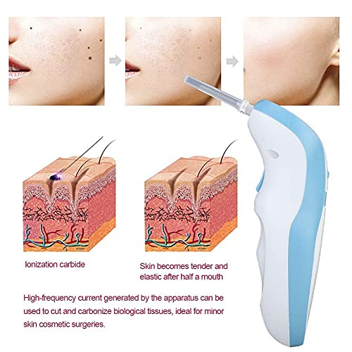 Fibroblast, párpado, levantamiento, plasma, moles, manchas, verrugas, máquina de eliminación, profesional(Azul)