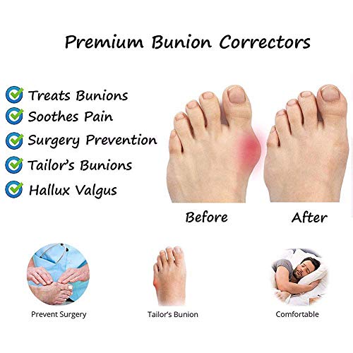 HJJGRASS Sandalias de corrección del Dedo Gordo del pie para Mujeres, Sandalias ortopédicas Bunion Corrector con Soporte para el Arco Puntera enderezar los Zapatos,Marrón,38