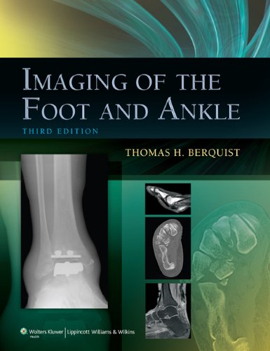 Imaging of the Foot and Ankle (English Edition)