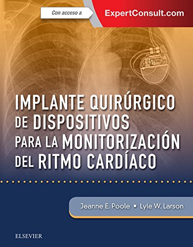 Implante quirúrgico de dispositivos para la monitorización del ritmo cardíaco