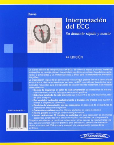 Interpretacion del ECG