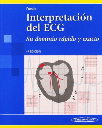 Interpretacion del ECG