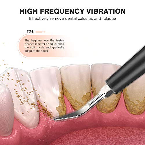 Irrigador Bucal , 3 Cabezales De Recambio , Limpieza Dental Completa Kit de limpieza eléctrica, herramienta profesional (orange)