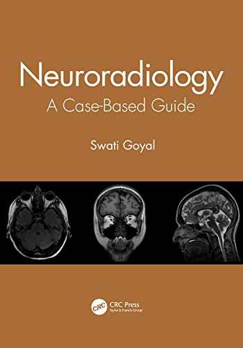 Neuroradiology: A Case-Based Guide