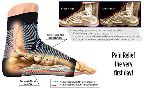 Orthosleeve media compresión graduada FS6, Negro, talla XL - 6 zonas de compresión -Producto específico para fascitis plantar y dolor en el talón - Mejora la circulación - Reduce la inflamación - Ayuda a la rehabilitación