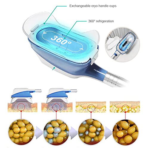 Portátil 360° Cryolipolysis Máquina para adelgazar, Equipos de Cryo Lipólisis 360° crioterapia Fisioterapia Cuerpo delgado, máquina de eliminación de papada,Small handle