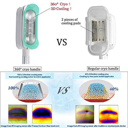 Portátil 360° Cryolipolysis Máquina para adelgazar, Equipos de Cryo Lipólisis 360° crioterapia Fisioterapia Cuerpo delgado, máquina de eliminación de papada,Small handle