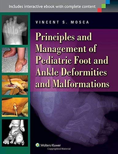 [(Principles and Management of Pediatric Foot and Ankle Deformities and Malformations: A Principles Based, Practical Guide to Their Assessment and Management)] [Author: Vincent S. Mosca] published on (July, 2014)