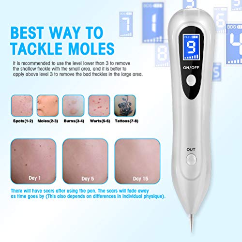 Quitar Verrugas Plasma Pen, Mole Removedor Quité Verrugas con Intensidad de 9 Niveles Pantalla LCD Manchas Cara Eliminación Manchita la Edad, Esputo, Pecas, Tatuajes