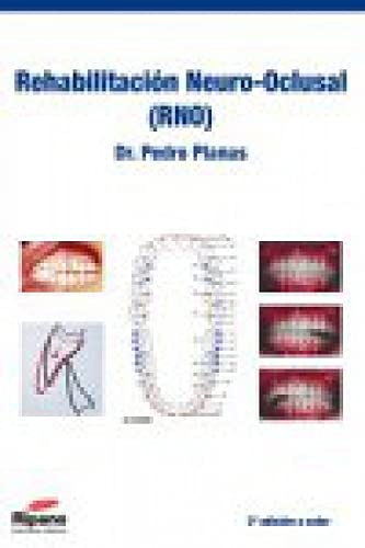 Rehabilitación Neuro-Oclusal (RNO)