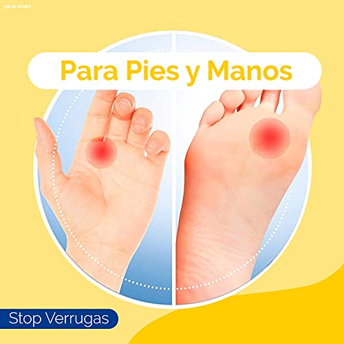 Scholl, Tratamiento Stop Verrugas Comunes y Plantares, por método de congelación, 80ml/53g