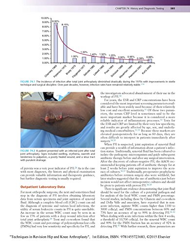 Techniques in Revision Hip and Knee Arthroplasty, 1e