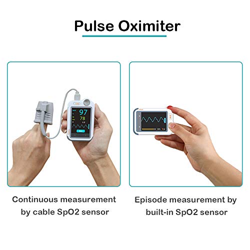 ViATOM Checkme Lite Plus Monitor Cardíaco, Bluetooth Monitor de ECG, Medidor Saturación Oxígeno, Monitor de Oxígeno para Bebés, Monitor de Salud Cardíaco Portátil, APP para iOS/Android, Informe de PC