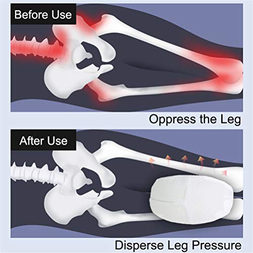 WDM Almohada De Rodilla, De Espuma De Memoria Almohada Ortopédica De Rodilla De La Pierna De La Almohadilla para La Ciática Nervio Liberación De Presión De Pata De Apoyo Dolor Articular,Azul