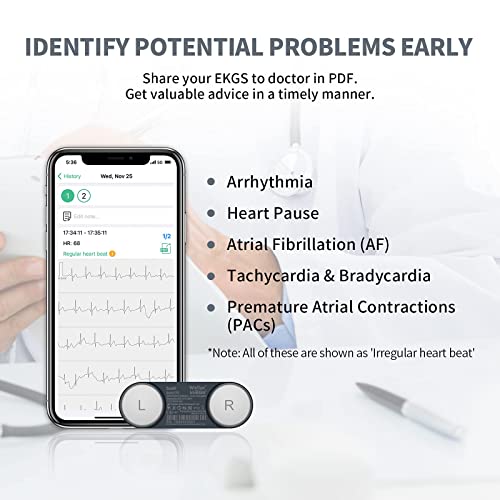 Wellue DuoEK Monitor ECG Portátil, Monitor de ECG del Cinturón Torácico, Bluetooth APP de Movíl para iOS y Android, Monitor de ECG Portátil para Uso Doméstico, Detección de 30s a 15mins