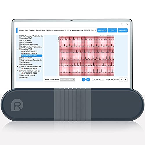 Wellue Monitor de ECG, Registrador Holter Profesional con Informe de Análisis AI-ECG, Registro Holter de ECG de 24 Horas, Software de Soporte para PC, Impresión de PDF de Forma de onda de ECG