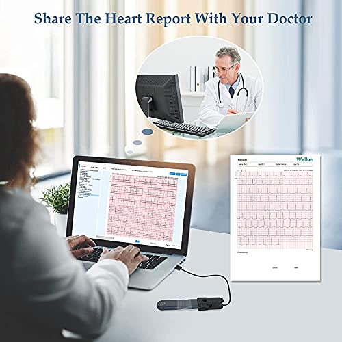 Wellue Monitor de ECG, Registrador Holter Profesional con Informe de Análisis AI-ECG, Registro Holter de ECG de 24 Horas, Software de Soporte para PC, Impresión de PDF de Forma de onda de ECG