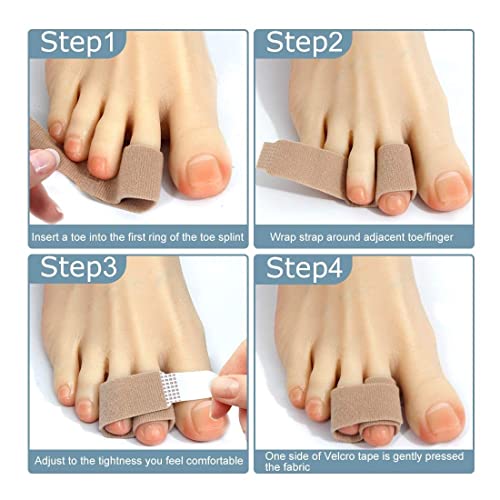 Zeayebsr 10pcs Hammer Toe Splint Vendaje Hammer Toe Vendaje Toe Splint es adecuado para dedos en martillo y dedos rotos