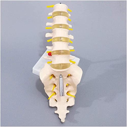 ZKZK Columna humana - Esta columna lumbar humana consta de cinco vértebras lumbares y sacro disco, nervios espinales s y médula espinal, Dura Mater de