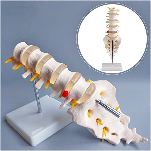 ZKZK Columna humana - Esta columna lumbar humana consta de cinco vértebras lumbares y sacro disco, nervios espinales s y médula espinal, Dura Mater de