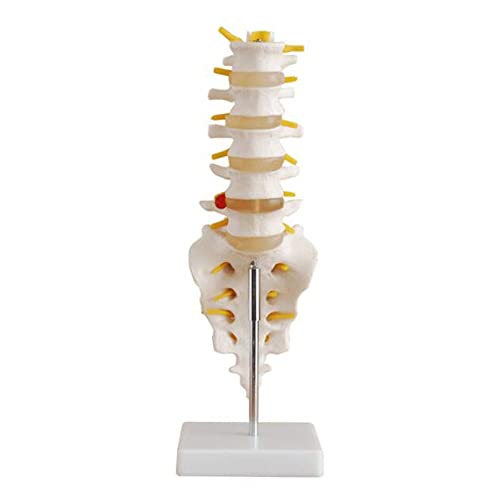 ZKZK Columna humana - Esta columna lumbar humana consta de cinco vértebras lumbares y sacro disco, nervios espinales s y médula espinal, Dura Mater de