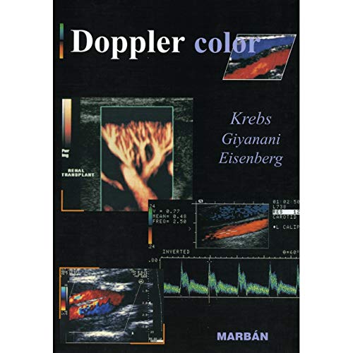 Doppler Color