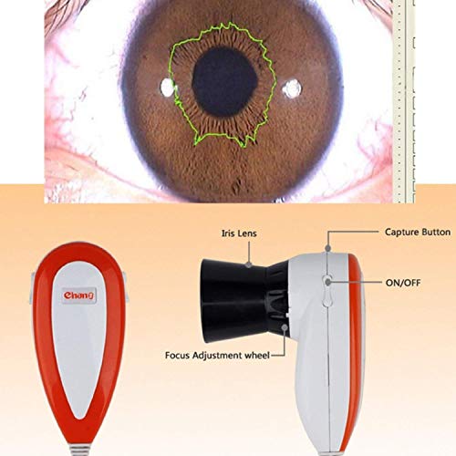 Emperor of Gadgets - Iriscopio, 5.0 MP, alta resolución, CCD, USB, incluye 30 lentes de iris y software de análisis