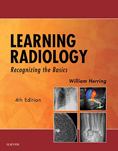 Learning Radiology: Recognizing the Basics (English Edition)