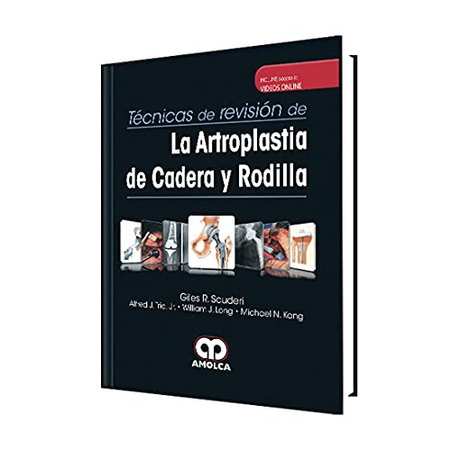 TECNICAS REVISION ARTROPLASTIA CADERA RODILLA VIDEOS ONLINE