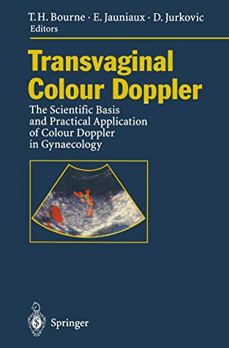 Transvaginal Colour Doppler: The Scientific Basis and Practical Application of Colour Doppler in Gynaecology