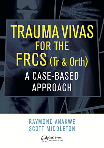 Trauma Vivas for the FRCS: A Case-Based Approach (English Edition)