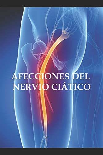 Afecciones del nervio ciático: 14 (Tratamientos naturales)