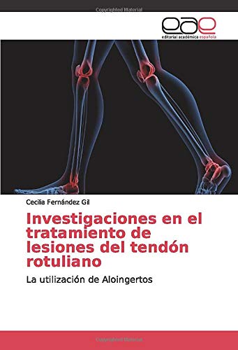 Investigaciones en el tratamiento de lesiones del tendón rotuliano: La utilización de Aloingertos