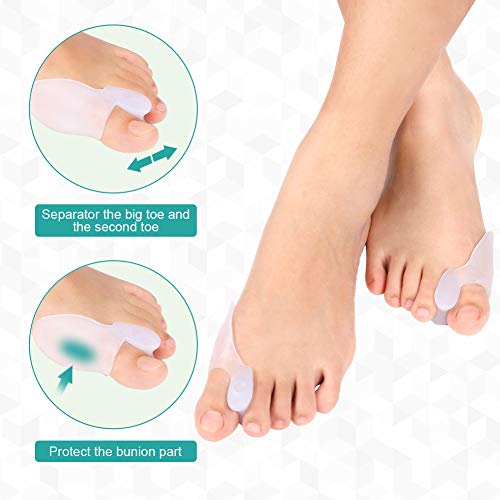 Kit de alisadores de gel para juanetes de guardia para hombres y mujeres, corrector Bursitis Hallux, rectificador para el tratamiento de puntas de martillo, bursitis